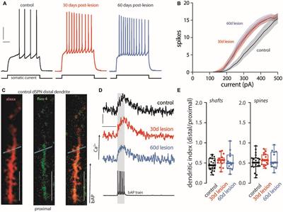 Delayed Spine Pruning of Direct Pathway Spiny Projection Neurons in a Mouse Model of Parkinson’s Disease